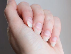 Weiße Flecken auf Fingernägeln